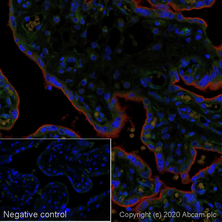 Immunohistochemistry (Formalin/PFA-fixed paraffin-embedded sections) - Alexa Fluor® 647 Anti-PD-L1 antibody [SP142] (AB267563), expandable thumbnail