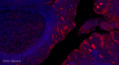 Immunohistochemistry (Formalin/PFA-fixed paraffin-embedded sections) - Alexa Fluor® 647 Anti-PD-L1 antibody [SP142] (AB267563), expandable thumbnail