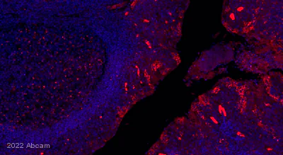 Immunohistochemistry (Formalin/PFA-fixed paraffin-embedded sections) - Alexa Fluor® 647 Anti-PD-L1 antibody [SP142] (AB267563)
