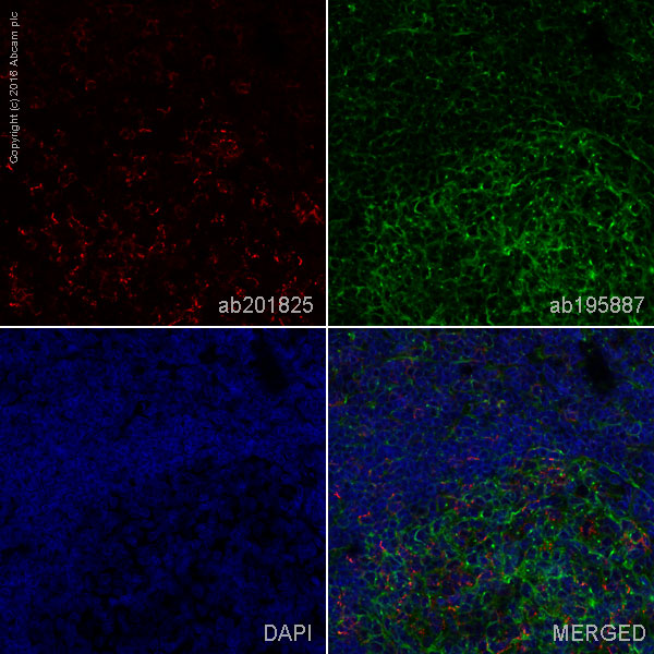 Immunohistochemistry (Formalin/PFA-fixed paraffin-embedded sections) - Alexa Fluor® 647 Anti-PD1 antibody [EPR4877(2)] (AB201825), expandable thumbnail