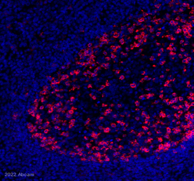 Immunohistochemistry (Formalin/PFA-fixed paraffin-embedded sections) - Alexa Fluor® 647 Anti-PD1 antibody [EPR4877(2)] (AB201825), expandable thumbnail