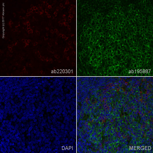 Immunohistochemistry (Formalin/PFA-fixed paraffin-embedded sections) - Alexa Fluor® 647 Anti-PD1 antibody [NAT105] (AB220301), expandable thumbnail