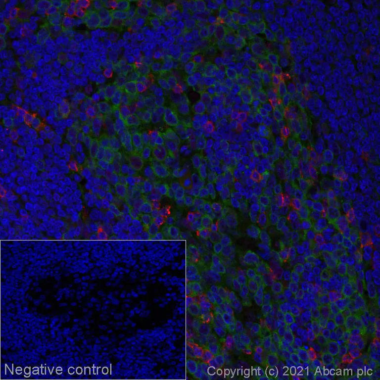 Immunohistochemistry (Formalin/PFA-fixed paraffin-embedded sections) - Alexa Fluor® 647 Anti-PD1 antibody [NAT105] (AB279695)