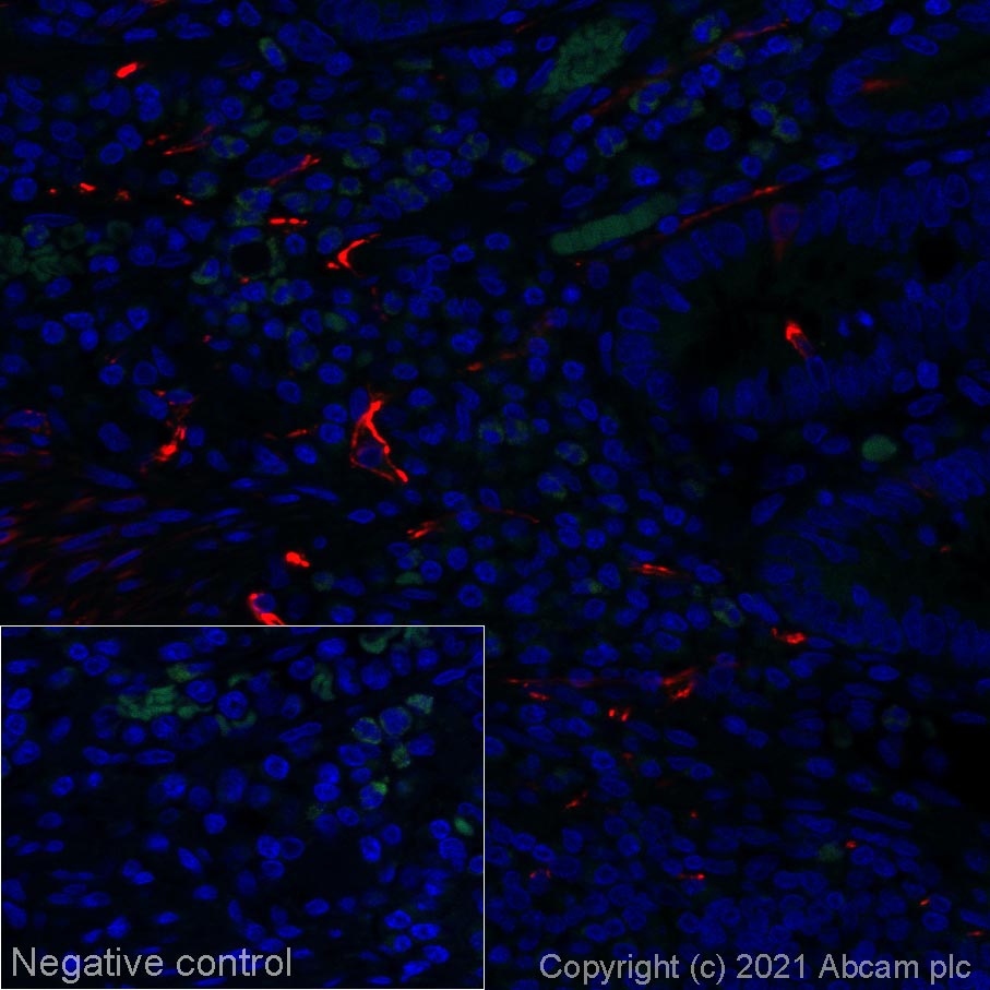 Immunohistochemistry (Formalin/PFA-fixed paraffin-embedded sections) - Alexa Fluor® 647 Anti-Peripherin antibody [EPR23445-28] (AB275151), expandable thumbnail