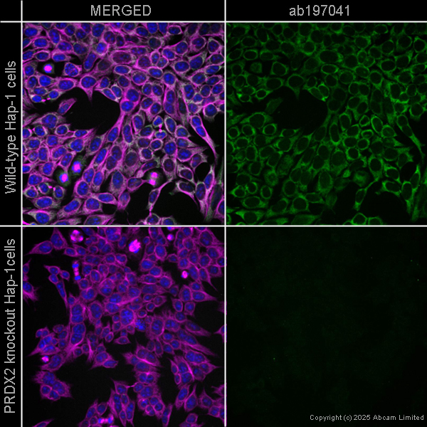 Immunocytochemistry/ Immunofluorescence - Alexa Fluor® 647 Anti-Peroxiredoxin 2/PRP antibody [EPR5154] (AB197041)