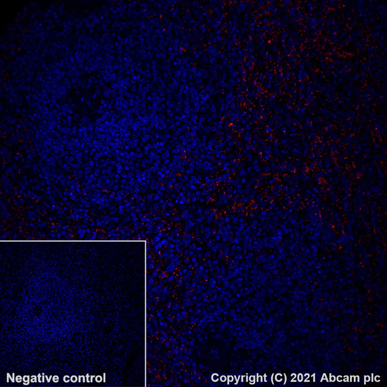 Immunohistochemistry (Formalin/PFA-fixed paraffin-embedded sections) - Alexa Fluor® 647 Anti-PF4 antibody [EPR7763] (AB280969)