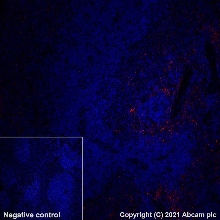 Immunohistochemistry (Formalin/PFA-fixed paraffin-embedded sections) - Alexa Fluor® 647 Anti-PF4 antibody [EPR7763] (AB280969)