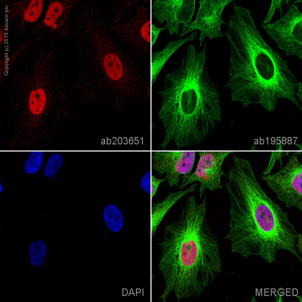 Immunocytochemistry/ Immunofluorescence - Alexa Fluor® 647 Anti-PFKFB3 antibody [EPR12594] (AB203651)