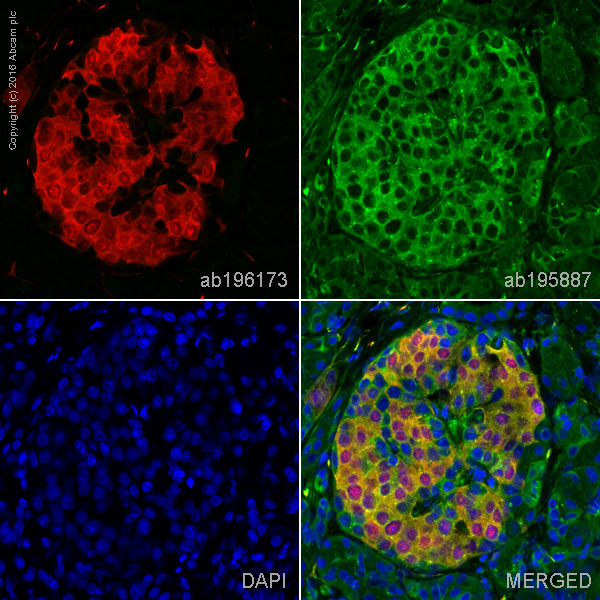 Immunohistochemistry (Formalin/PFA-fixed paraffin-embedded sections) - Alexa Fluor® 647 Anti-PGP9.5 antibody [EPR4118] - Neuronal Marker (AB196173), expandable thumbnail