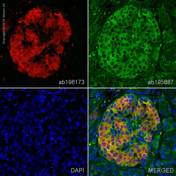 Immunohistochemistry (Formalin/PFA-fixed paraffin-embedded sections) - Alexa Fluor® 647 Anti-PGP9.5 antibody [EPR4118] - Neuronal Marker (AB196173)