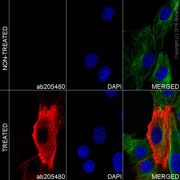 Immunocytochemistry/ Immunofluorescence - Alexa Fluor® 647 Anti-Phosphotyrosine antibody [EPR16871] (AB205480)
