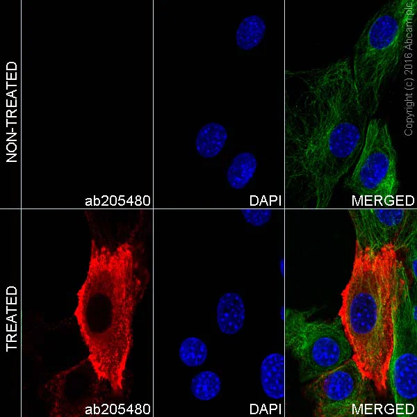 Immunocytochemistry/ Immunofluorescence - Alexa Fluor® 647 Anti-Phosphotyrosine antibody [EPR16871] (AB205480)