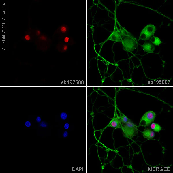 Immunocytochemistry/ Immunofluorescence - Alexa Fluor® 647 Anti-Phosphotyrosine antibody [PY20] (AB197508)