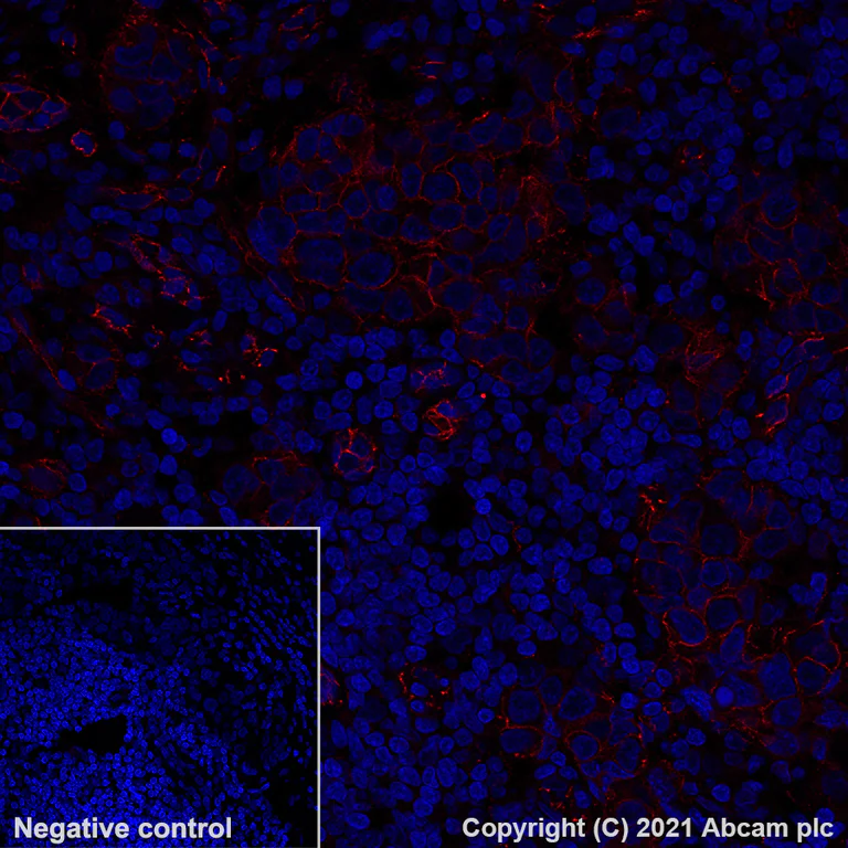 Immunohistochemistry (Formalin/PFA-fixed paraffin-embedded sections) - Alexa Fluor® 647 Anti-PI 3 Kinase catalytic subunit alpha/PIK3CA antibody [SP139] (AB283820)