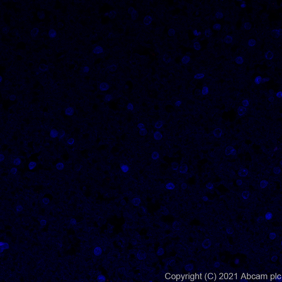 Immunohistochemistry (Formalin/PFA-fixed paraffin-embedded sections) - Alexa Fluor® 647 Anti-PI 3 Kinase catalytic subunit alpha/PIK3CA antibody [SP139] (AB283820)