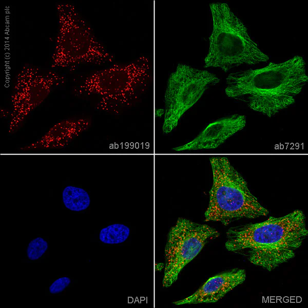 Immunocytochemistry/ Immunofluorescence - Alexa Fluor® 647 Anti-PMP70 antibody [EPR5614] (AB199019)