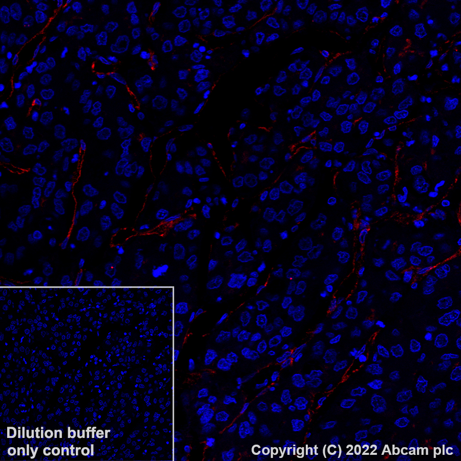 Immunohistochemistry (Formalin/PFA-fixed paraffin-embedded sections) - Alexa Fluor® 647 Anti-PODXL antibody [EPR9518] (AB307402)