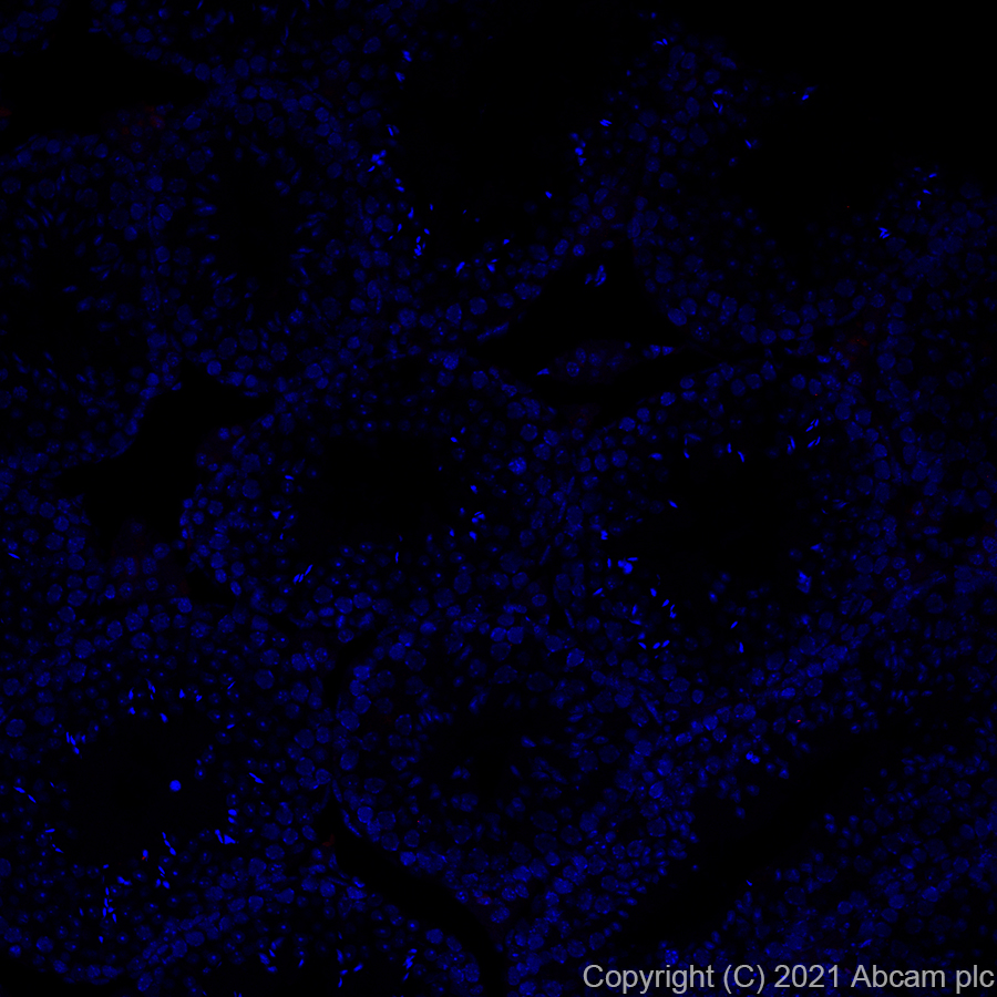 Immunohistochemistry (Formalin/PFA-fixed paraffin-embedded sections) - Alexa Fluor® 647 Anti-PR3 antibody [EPR23253-35] (AB282194)