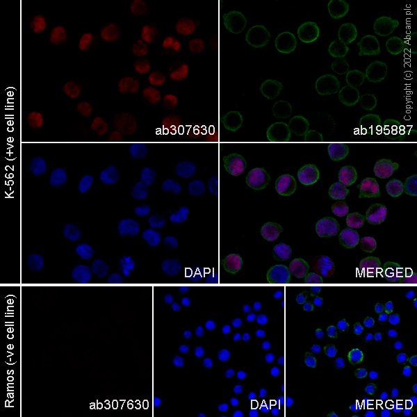Immunocytochemistry/ Immunofluorescence - Alexa Fluor® 647 Anti-PRAME antibody [EPR20330] (AB307630), expandable thumbnail