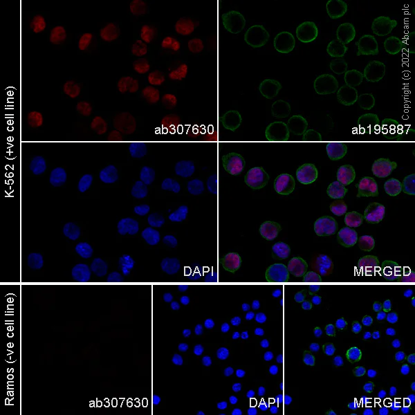 Immunocytochemistry/ Immunofluorescence - Alexa Fluor® 647 Anti-PRAME antibody [EPR20330] (AB307630)