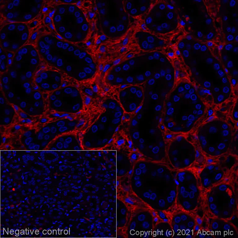 Immunohistochemistry (Formalin/PFA-fixed paraffin-embedded sections) - Alexa Fluor® 647 Anti-Pro-Collagen III alpha 1 antibody [EPR24255-13] (AB286830)