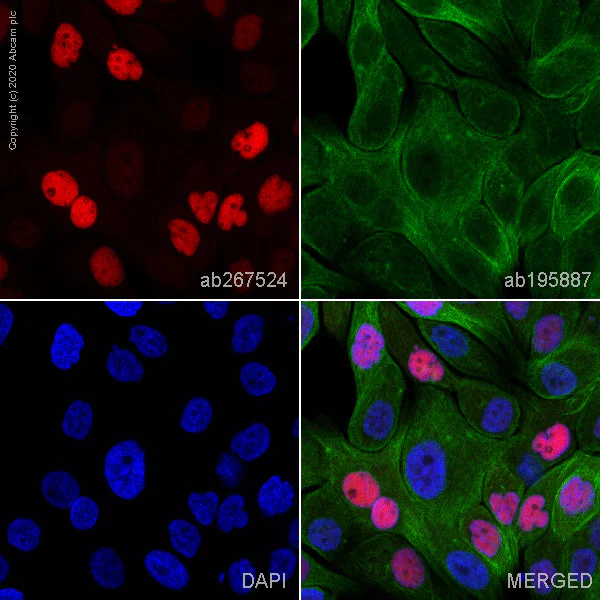Immunocytochemistry/ Immunofluorescence - Alexa Fluor® 647 Anti-Progesterone Receptor antibody [SP2] (AB267524)
