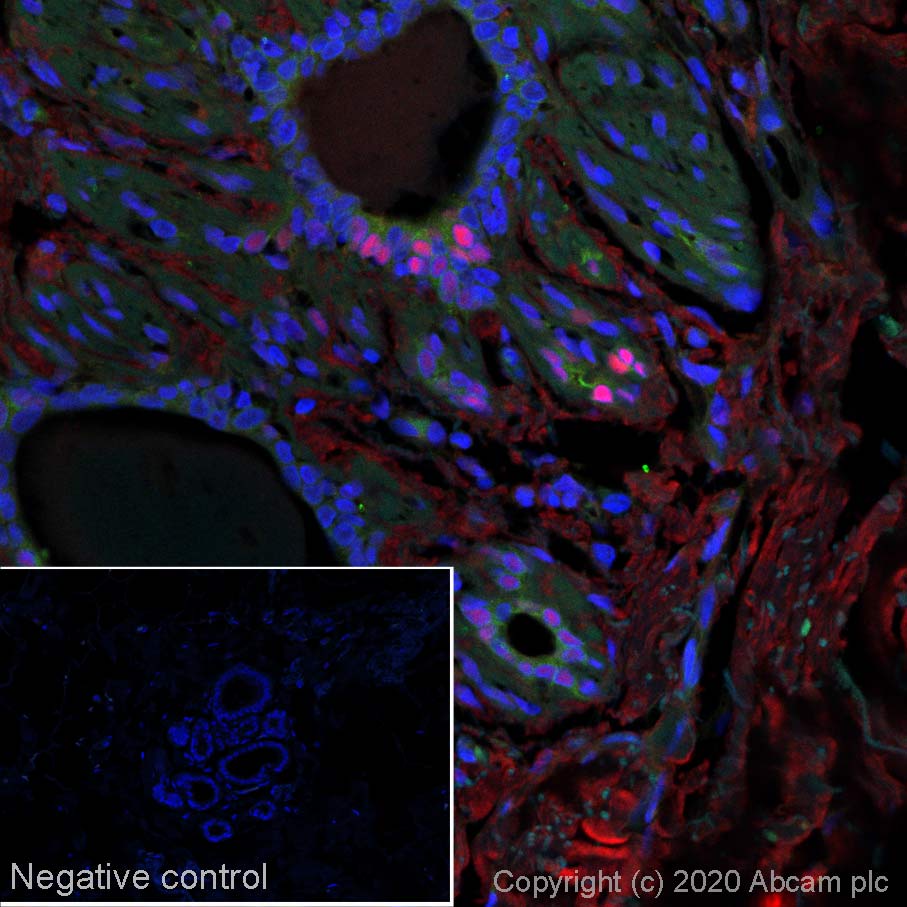 Immunohistochemistry (Formalin/PFA-fixed paraffin-embedded sections) - Alexa Fluor® 647 Anti-Progesterone Receptor antibody [SP2] (AB267524), expandable thumbnail