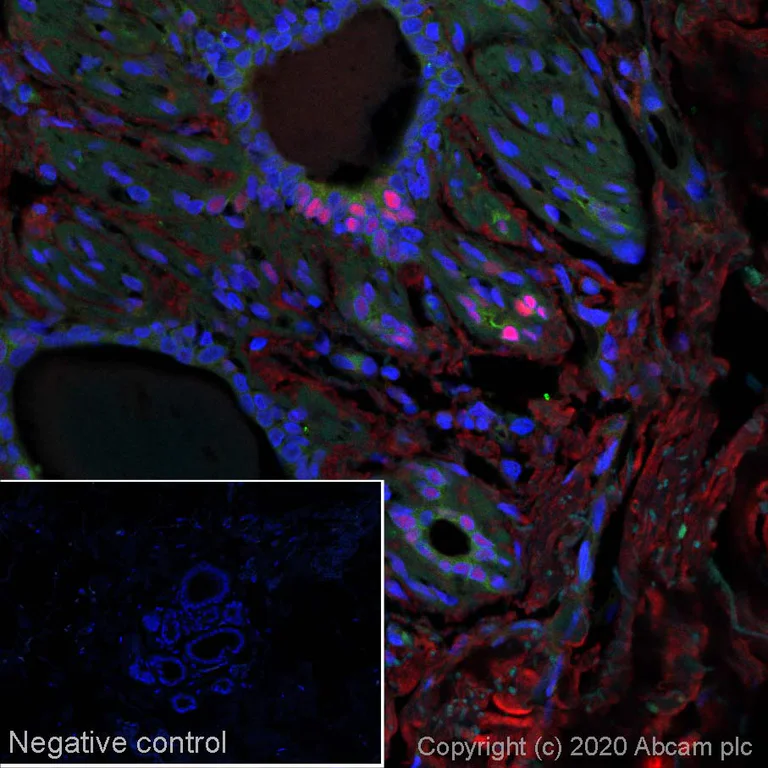 Immunohistochemistry (Formalin/PFA-fixed paraffin-embedded sections) - Alexa Fluor® 647 Anti-Progesterone Receptor antibody [SP2] (AB267524)