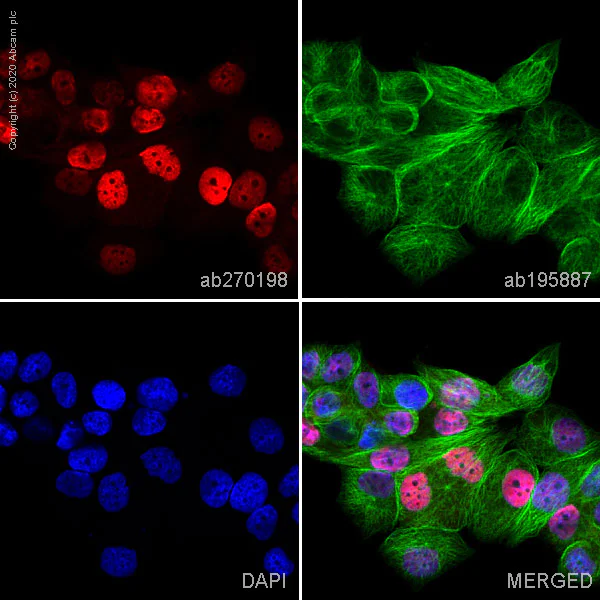 Immunocytochemistry/ Immunofluorescence - Alexa Fluor® 647 Anti-Progesterone Receptor antibody [SP42] (AB270198)