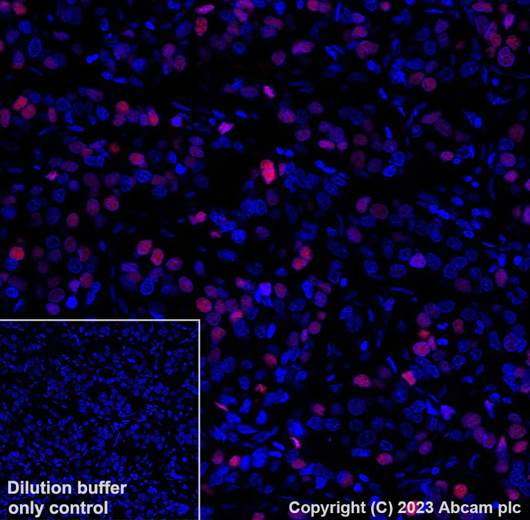 Immunohistochemistry (Formalin/PFA-fixed paraffin-embedded sections) - Alexa Fluor® 647 Anti-Progesterone Receptor antibody [YR85] (AB310043)