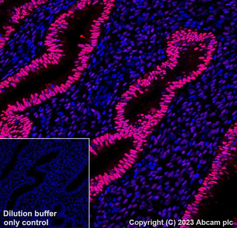Immunohistochemistry (Formalin/PFA-fixed paraffin-embedded sections) - Alexa Fluor® 647 Anti-Progesterone Receptor antibody [YR85] (AB310043)