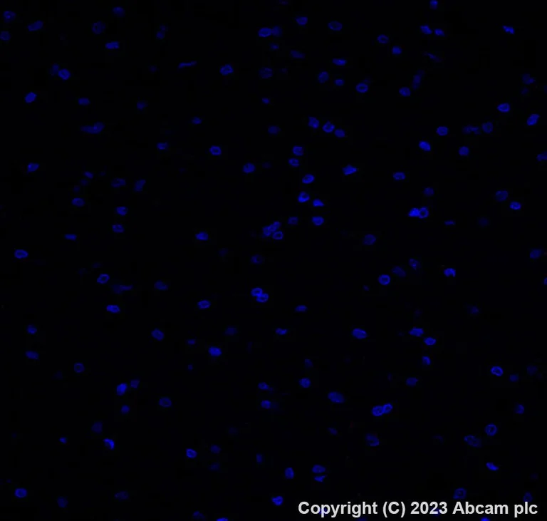 Immunohistochemistry (Formalin/PFA-fixed paraffin-embedded sections) - Alexa Fluor® 647 Anti-Progesterone Receptor antibody [YR85] (AB310043)