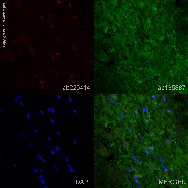 Immunohistochemistry (Frozen sections) - Alexa Fluor® 647 Anti-PROX1 antibody [EPR19273] (AB225414)