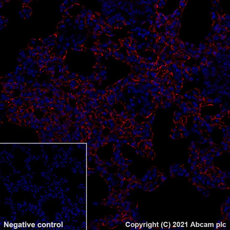 Immunohistochemistry (Formalin/PFA-fixed paraffin-embedded sections) - Alexa Fluor® 647 Anti-PRX antibody [EPR24150-36] (AB283350)