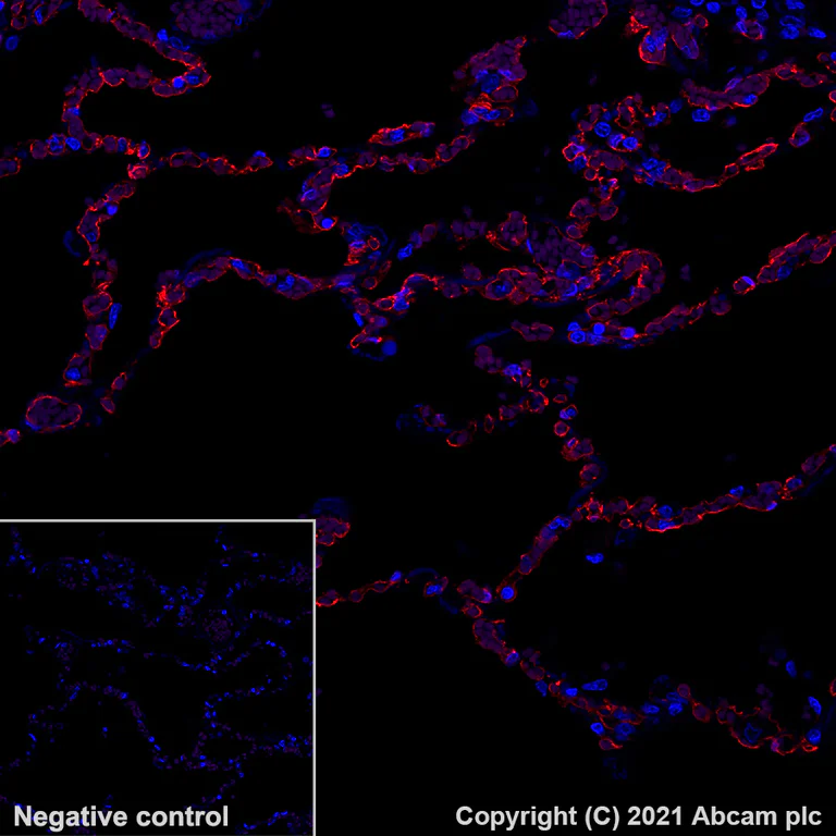 Immunohistochemistry (Formalin/PFA-fixed paraffin-embedded sections) - Alexa Fluor® 647 Anti-PRX antibody [EPR24150-36] (AB283350)