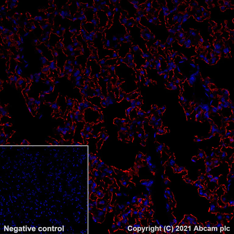 Immunohistochemistry (Formalin/PFA-fixed paraffin-embedded sections) - Alexa Fluor® 647 Anti-PRX antibody [EPR24150-36] (AB283350)