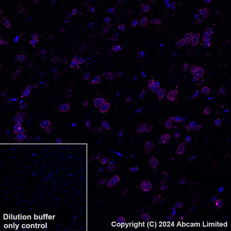 Immunohistochemistry (Formalin/PFA-fixed paraffin-embedded sections) - Alexa Fluor® 647 Anti-PSMA antibody [EPR28358-8] (AB320787)