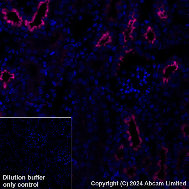 Immunohistochemistry (Formalin/PFA-fixed paraffin-embedded sections) - Alexa Fluor® 647 Anti-PSMA antibody [EPR28358-8] (AB320787)