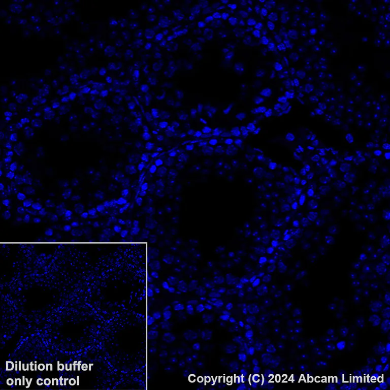 Immunohistochemistry (Formalin/PFA-fixed paraffin-embedded sections) - Alexa Fluor® 647 Anti-PSMA antibody [EPR28358-8] (AB320787)