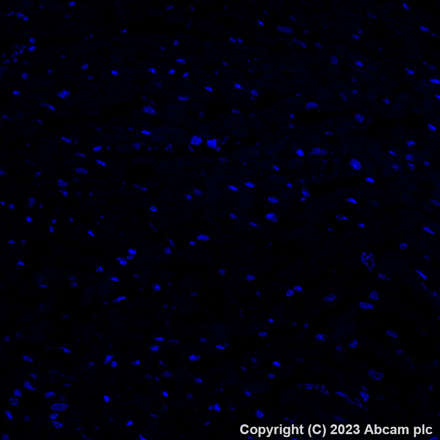 Immunohistochemistry (Formalin/PFA-fixed paraffin-embedded sections) - Alexa Fluor® 647 Anti-PSMA antibody [EPR6253] (AB313352)