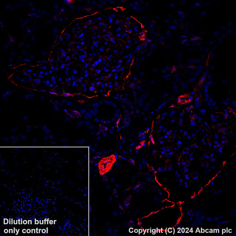 Immunohistochemistry (Formalin/PFA-fixed paraffin-embedded sections) - Alexa Fluor® 647 Anti-PTRF antibody [EPR27006-67] (AB318173)