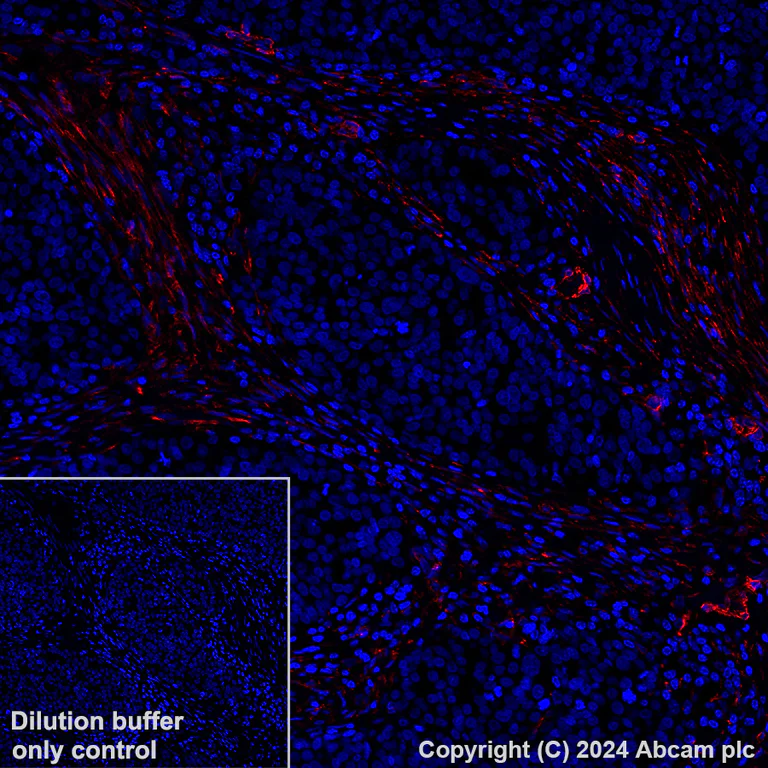 Immunohistochemistry (Formalin/PFA-fixed paraffin-embedded sections) - Alexa Fluor® 647 Anti-PTRF antibody [EPR27006-67] (AB318173)