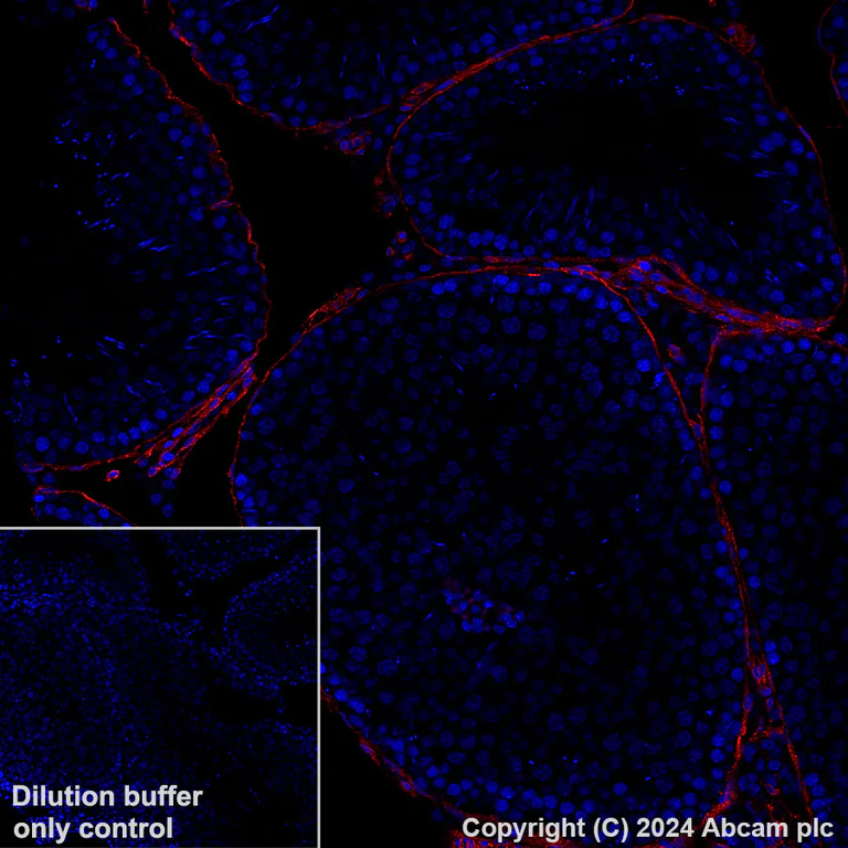 Immunohistochemistry (Formalin/PFA-fixed paraffin-embedded sections) - Alexa Fluor® 647 Anti-PTRF antibody [EPR27006-67] (AB318173)