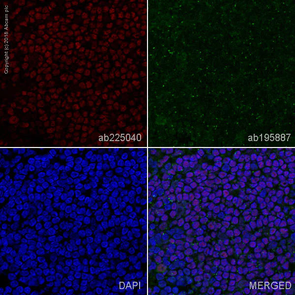 Immunohistochemistry (Frozen sections) - Alexa Fluor® 647 Anti-PU.1/Spi1 antibody [EPR3158Y] (AB225040)