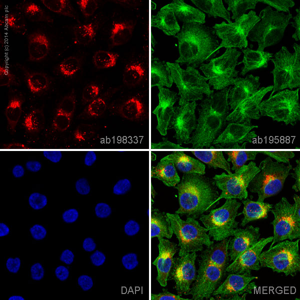 Immunocytochemistry/ Immunofluorescence - Alexa Fluor® 647 Anti-RAB7 antibody [EPR7589] (AB198337), expandable thumbnail