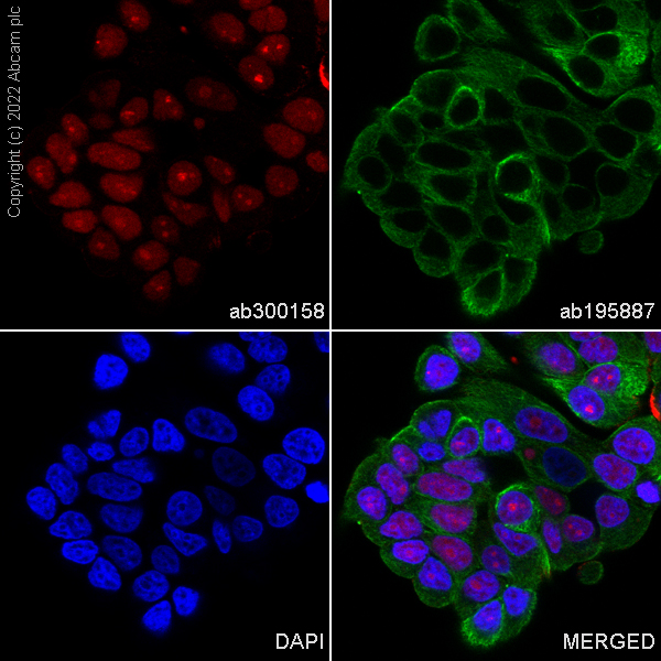 Immunocytochemistry/ Immunofluorescence - Alexa Fluor® 647 Anti-Rb antibody [EPR17512] (AB300158), expandable thumbnail