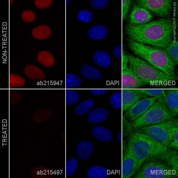 Immunocytochemistry/ Immunofluorescence - Alexa Fluor® 647 Anti-Rb (phospho S807) antibody [EPR17732] (AB215947), expandable thumbnail