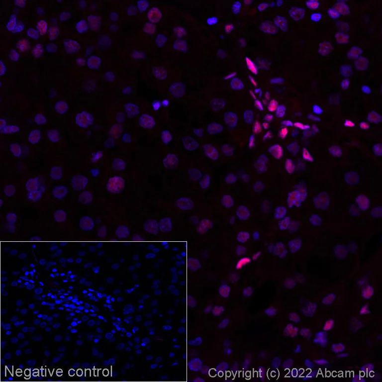 Immunohistochemistry (Formalin/PFA-fixed paraffin-embedded sections) - Alexa Fluor® 647 Anti-RBBP7 antibody [EPR23796-74] (AB286823)