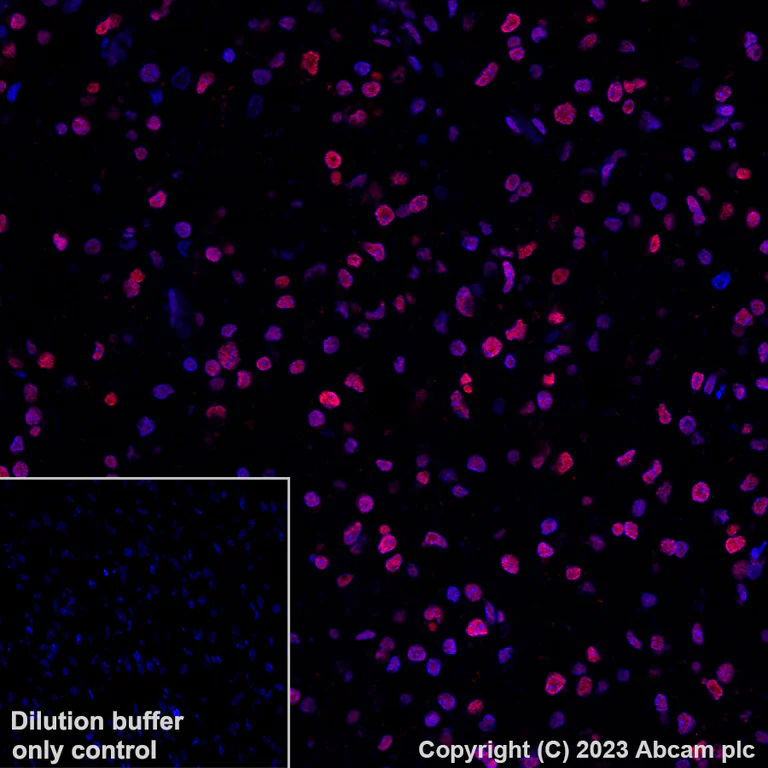 Immunohistochemistry (Formalin/PFA-fixed paraffin-embedded sections) - Alexa Fluor® 647 Anti-RBM3 antibody [EPR6061(2)] (AB314932)