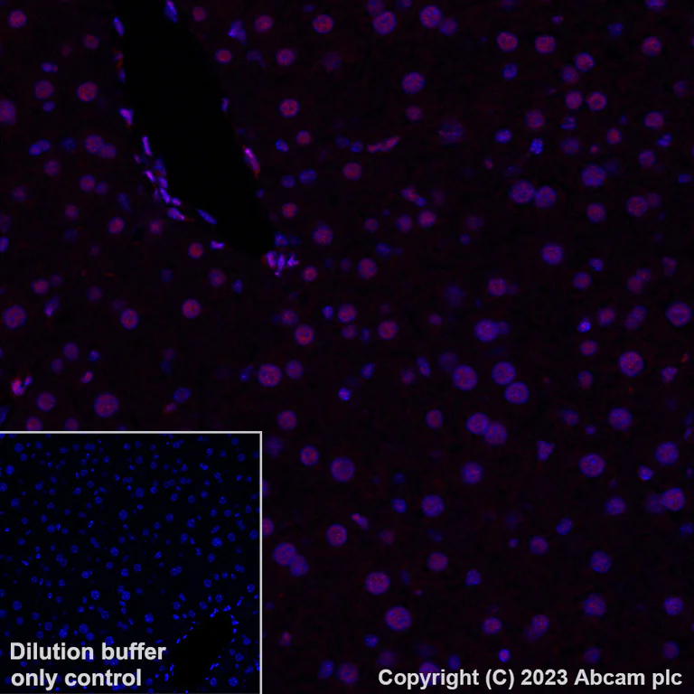 Immunohistochemistry (Formalin/PFA-fixed paraffin-embedded sections) - Alexa Fluor® 647 Anti-RBM3 antibody [EPR6061(2)] (AB314932)